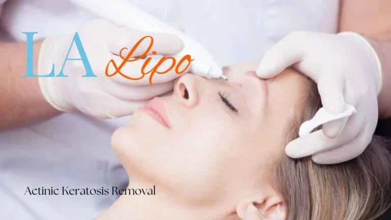 Woman receiving Actinic Keratosis Removal Treatment Rushden