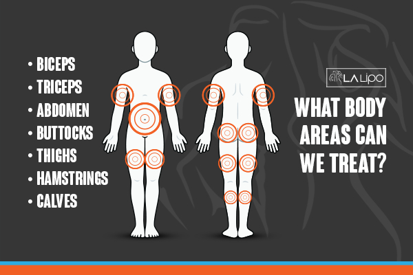 Graphic to show areas you can have LA-EMS Body Sculpting Rushden treatment.