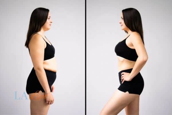 Picture of womans before and after using LA-EMS body sculpting to improve her core strength Rushden