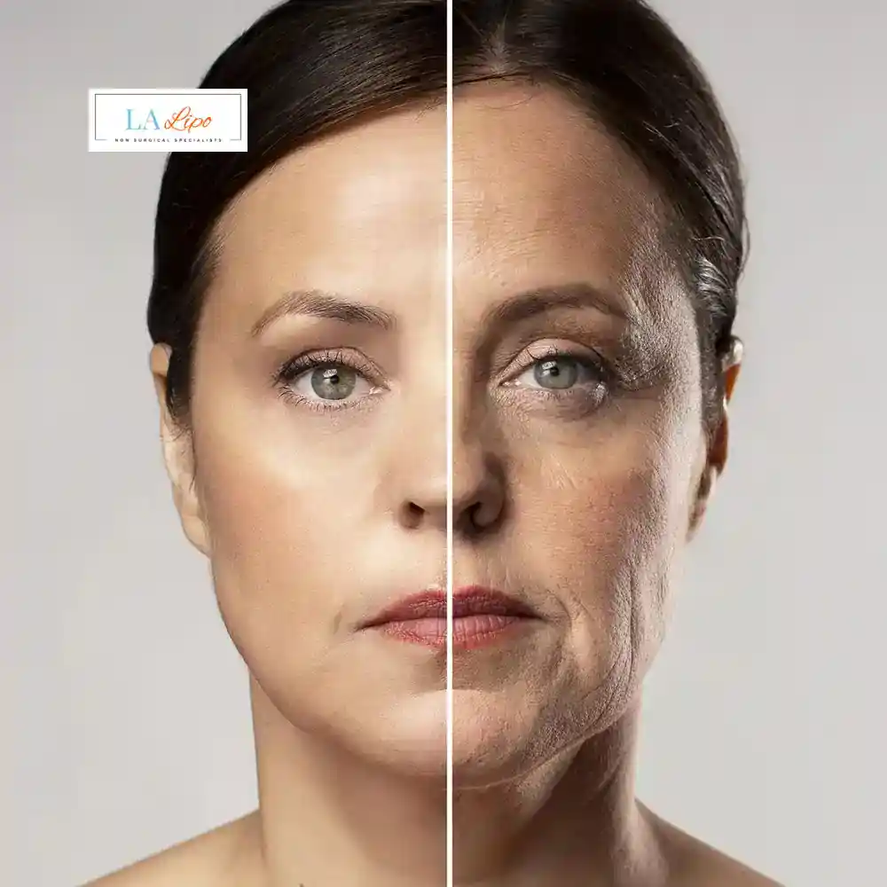 How Can You Tell If Non-Surgical Skin Tightening Is Right for You Rushden?