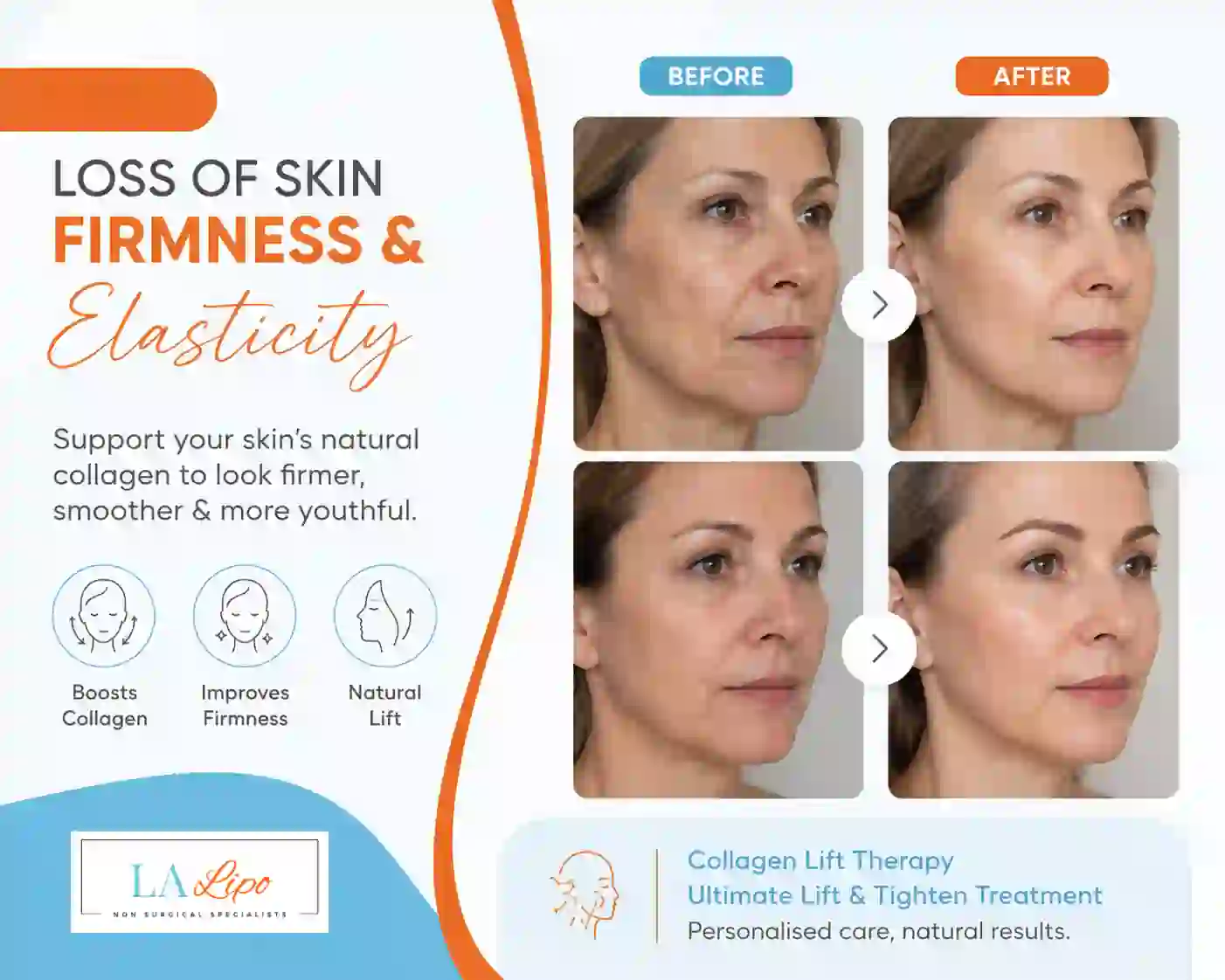 Sign #7: Loss of Skin Firmness and Elasticity Rushden